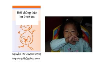 Hội chứng thận
hư ở trẻ em
Nguyễn Thị Quỳnh Hương
ntqhuong18@yahoo.com
 