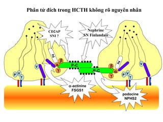 γ
VP
T
P-C
α3 β3 α3 β3
Z
P-C
α3 β3
α3 β3
β
β
γ
α
Z
α V
V
VP
T
Phân tử đích trong HCTH không rõ nguyên nhân
Nephrine
SN Finlandais
α-actinine
FSGS1
podocine
NPHS2
CD2AP
SNI ?
 