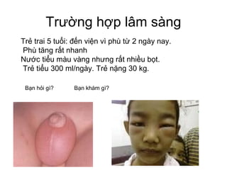 Trường hợp lâm sàng
Trẻ trai 5 tuổi: đến viện vì phù từ 2 ngày nay.
Phù tăng rất nhanh
Nước tiểu màu vàng nhưng rất nhiều bọt.
Trẻ tiểu 300 ml/ngày. Trẻ nặng 30 kg.
Bạn khám gì?Bạn hỏi gì?
 