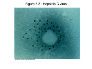 Figure 5.2 - Hepatitis C virus ©Copyright Science Press Internet Services 