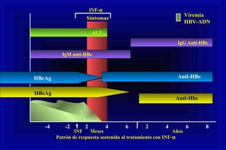 -4 -2 2 4 6 2 4 6 8
Síntomas
IgM anti-HBc
IgG Anti-HBc
ALT
HBeAg
Anti-HBe
Anti-Hbs
Viremia
HBV-ADN
INF Meses Años
Patrón de respuesta sostenida al tratamiento con INF-α
INF-α
HBsAg
HBeAg
HBsAg
 