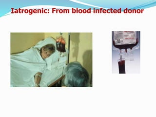 Iatrogenic: From blood infected donor
 