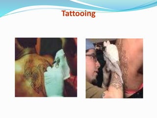Tattooing
 