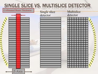 SINGLE SLICE VS. MULTISLICE DETECTOR
Z-Axis
Collimated Beam Thickness
Single slice
detector
Multislice
detector
 