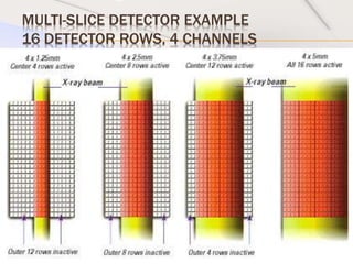 MULTI-SLICE DETECTOR EXAMPLE
16 DETECTOR ROWS, 4 CHANNELS
 
