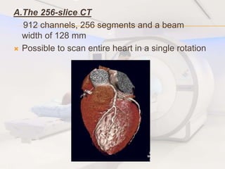 A.The 256-slice CT
912 channels, 256 segments and a beam
width of 128 mm
 Possible to scan entire heart in a single rotation
 