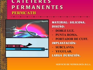 CATÉTERES PERMANENTES PERMCATH MATERIAL: SILICONA. DISEÑO: DOBLE LUZ. PUNTA ROMA. PORTADOR DE CUFF. IMPLANTACIÓN : SUBCLAVIA YUGULAR. LARGA DURACIÓN. SERVICIO DE NEFROLOGÍA H.G.A. 