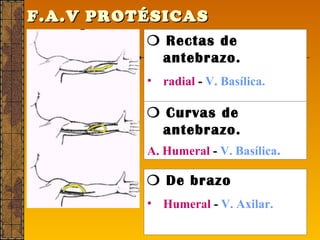 F.A.V PROTÉSICAS        Rectas de antebrazo. radial   -  V. Basílica.    Curvas de antebrazo. A. Humeral   -  V. Basílica .    De brazo Humeral   -  V. Axilar. 