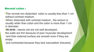 Not Well Developed Hirschsprung disease radiology and imaging | PPTX