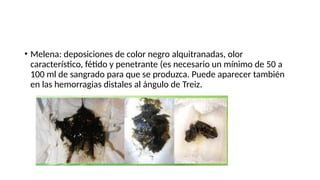 • Melena: deposiciones de color negro alquitranadas, olor
característico, fétido y penetrante (es necesario un mínimo de 50 a
100 ml de sangrado para que se produzca. Puede aparecer también
en las hemorragias distales al ángulo de Treiz.
 