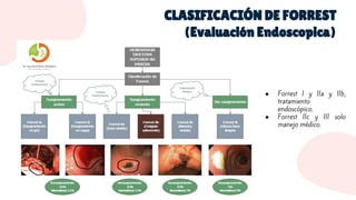 HEMORRAGIA DIGESTIVA ALTA, VARICEAL Y NO VARICEAL | PDF
