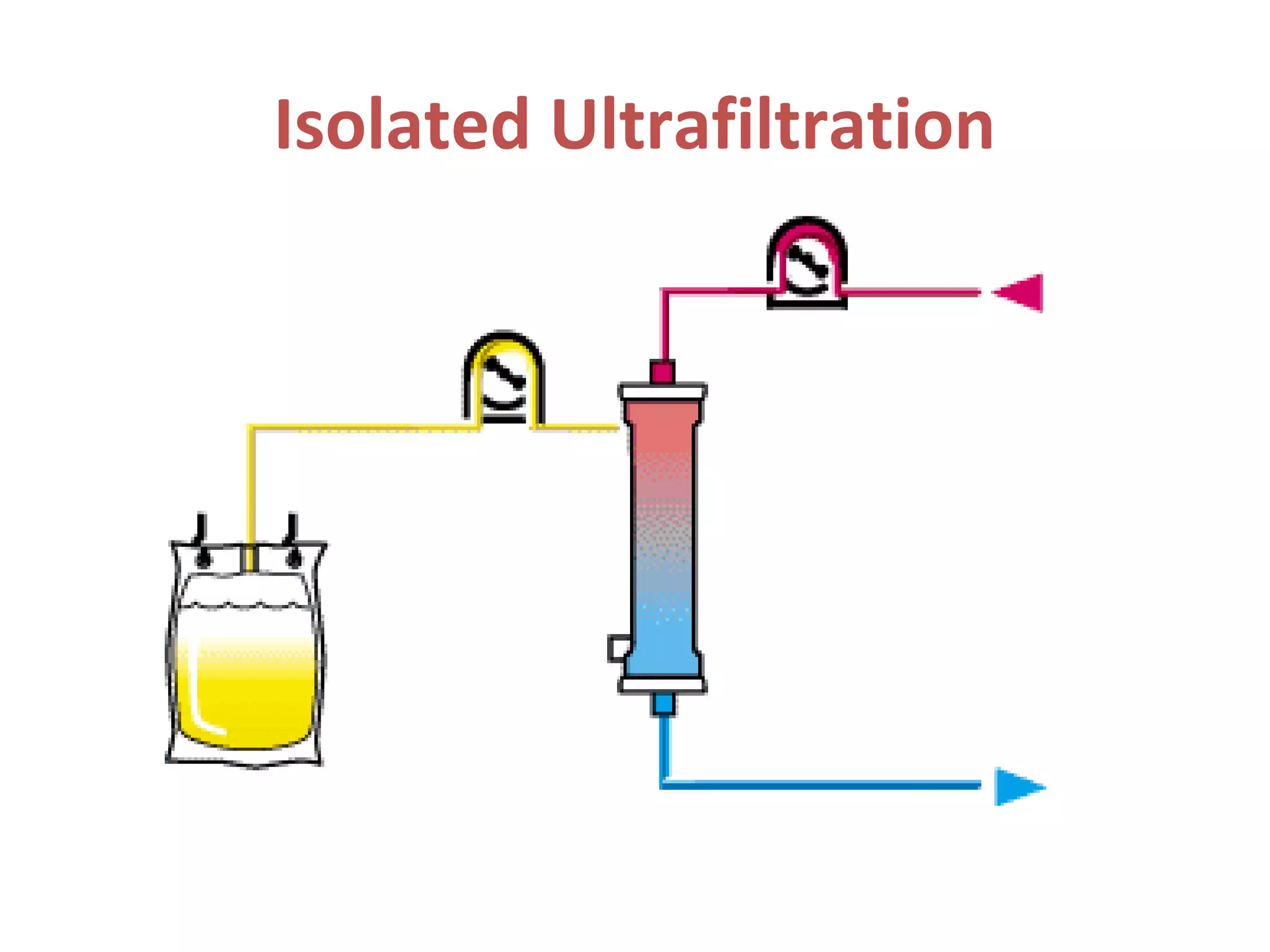 Isolated Ultrafiltration
 