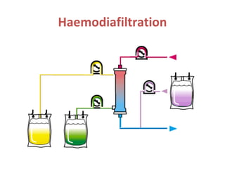 Haemodiafiltration
 