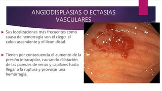ANGIODISPLASIAS O ECTASIAS
VASCULARES
 Sus localizaciones más frecuentes como
causa de hemorragia son el ciego, el
colon ascendente y el íleon distal.
 Tienen por consecuencia el aumento de la
presión intracapilar, causando dilatación
de las paredes de venas y capilares hasta
llegar a la ruptura y provocar una
hemorragia.
 