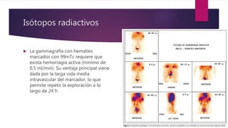 Isótopos radiactivos
 La gammagrafía con hematíes
marcados con 99mTc requiere que
exista hemorragia activa (mínimo de
0,5 ml/min). Su ventaja principal viene
dada por la larga vida media
intravascular del marcador, lo que
permite repetir la exploración a lo
largo de 24 h
 