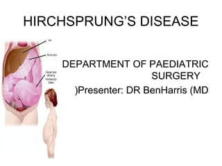HIRCHSPRUNG’S DISEASE 
DEPARTMENT OF PAEDIATRIC 
SURGERY 
(Presenter: DR BenHarris (MD 
 