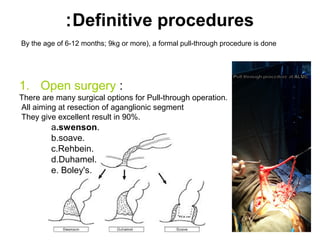 :Definitive procedures 
By the age of 6-12 months; 9kg or more), a formal pull-through procedure is done 
1. Open surgery : 
There are many surgical options for Pull-through operation. 
All aiming at resection of aganglionic segment 
They give excellent result in 90%. 
a.swenson. 
b.soave. 
c.Rehbein. 
d.Duhamel. 
e. Boley's. 
 