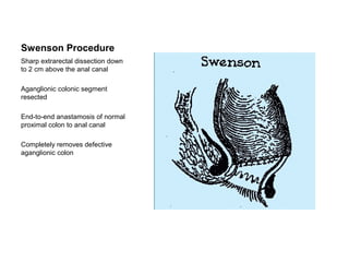 Swenson Procedure 
Sharp extrarectal dissection down 
to 2 cm above the anal canal 
Aganglionic colonic segment 
resected 
End-to-end anastamosis of normal 
proximal colon to anal canal 
Completely removes defective 
aganglionic colon 
 