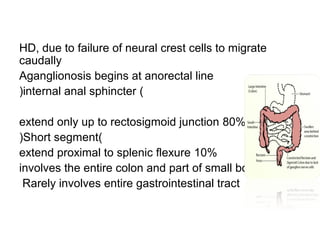 HD, due to failure of neural crest cells to migrate 
caudally 
Aganglionosis begins at anorectal line 
(internal anal sphincter ( 
extend only up to rectosigmoid junction 80% 
(Short segment( 
extend proximal to splenic flexure 10% 
involves the entire colon and part of small bowel 10% 
Rarely involves entire gastrointestinal tract 
 