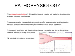 PATHOPHYSIOLOGY 
• The gross pathologic feature of HD is a dilated proximal intestine with gradual or abrupt transition 
to normal calibrated distal intestine . . 
• The colon proximal to the aganglionic segment, in an effort to overcome the partial obstruction, 
becomes distended and its wall markedly thickened because of muscle hypertrophy 
• The degree of hypertrophy and dilatation depends upon the duration and degree of obstruction 
and thus, indirectly to the age of the patient. 
• TZ is typically funnel like or cone shaped 
 