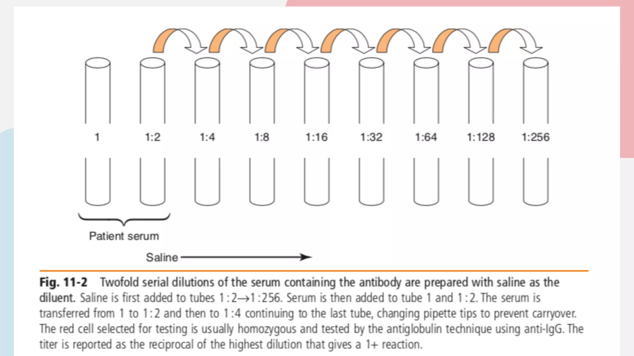 Hemolytic Disease of the Fetus and Newborn (HDFN) | PDF