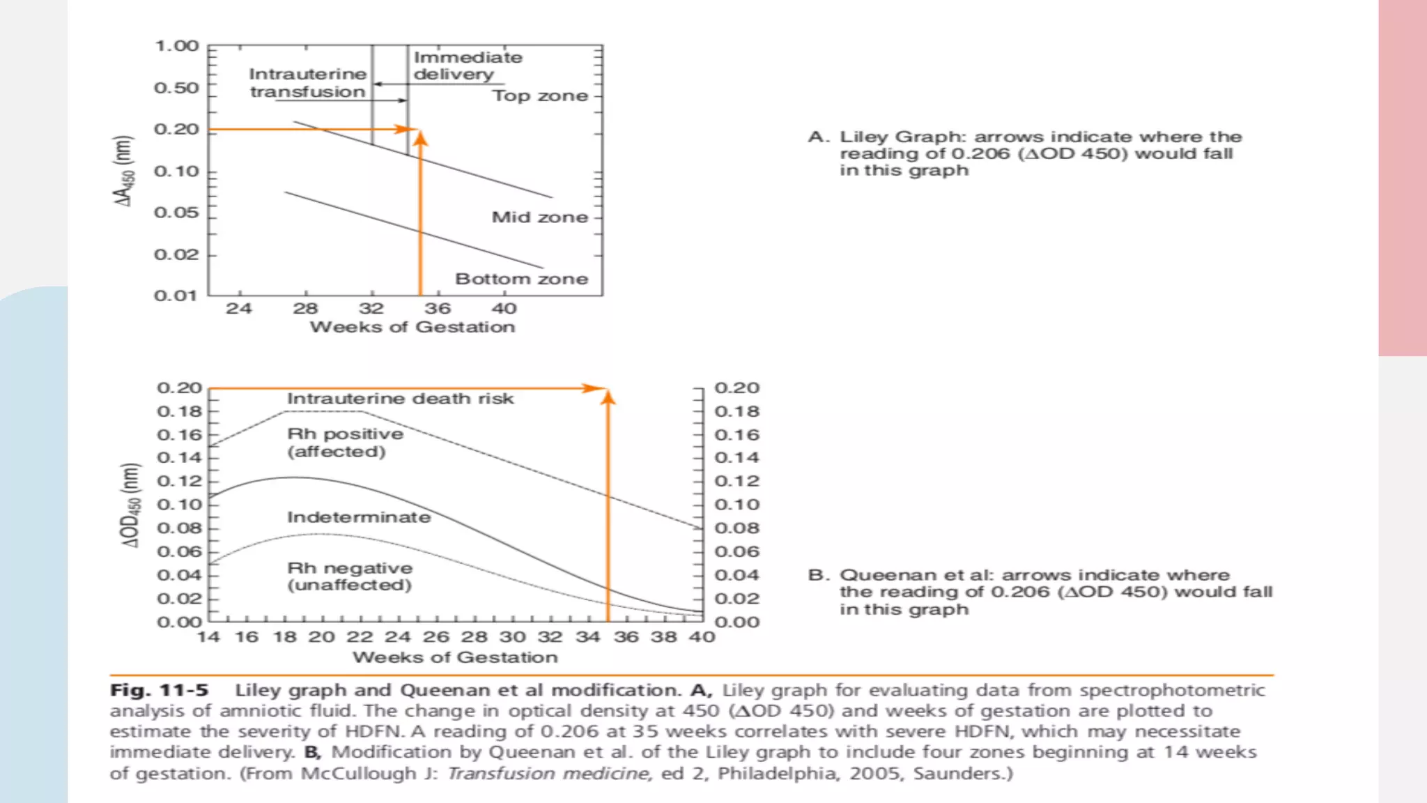 Hemolytic Disease of the Fetus and Newborn (HDFN) | PDF