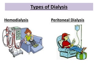 Types of Dialysis
Hemodialysis Peritoneal Dialysis
 