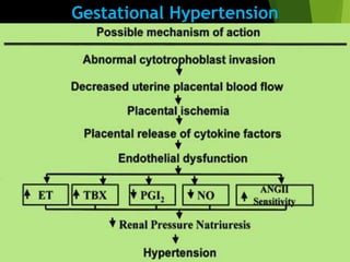 Gestational Hypertension
 