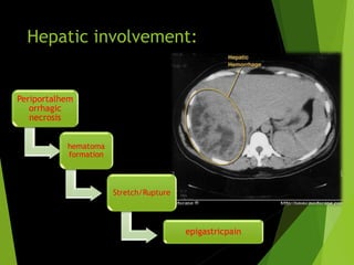Hepatic involvement:
Periportalhem
orrhagic
necrosis
hematoma
formation
Stretch/Rupture
epigastricpain
 