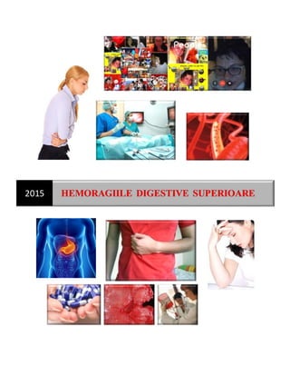2015 HEMORAGIILE DIGESTIVE SUPERIOARE
 