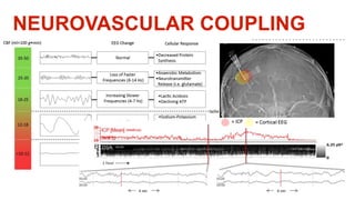 NEUROVASCULAR COUPLING
 