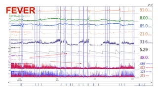 FEVER
 