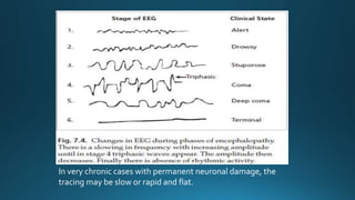 In very chronic cases with permanent neuronal damage, the
tracing may be slow or rapid and flat.
 