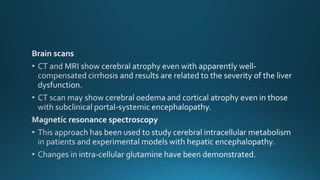Hepatic Encephalopathy