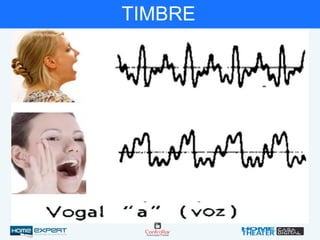 TIMBRE
 