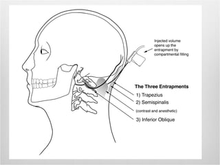 Neck Injection Positioning head and neck injections.ppt