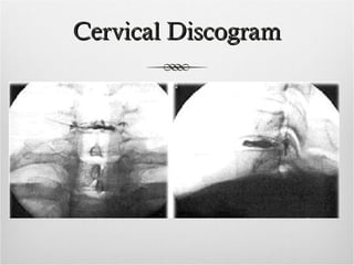 head and neck injections.ppt