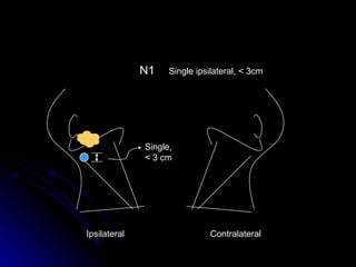Ipsilateral  Contralateral  N1 Single,< 3 cm Single ipsilateral, < 3cm 