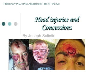 Head injuries and Concussions By Joseph Salinitri Preliminary P.D.H.P.E: Assessment Task 4; First Aid 