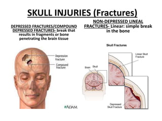 SKULL INJURIES (Fractures)
DEPRESSED FRACTURES/COMPOUND
DEPRESSED FRACTURES- break that
results in fragments or bone
penetrating the brain tissue
NON-DEPRESSED LINEAL
FRACTURES- Linear: simple break
in the bone
 