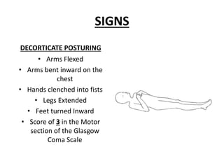SIGNS
DECORTICATE POSTURING
• Arms Flexed
• Arms bent inward on the
chest
• Hands clenched into fists
• Legs Extended
• Feet turned Inward
• Score of 3 in the Motor
section of the Glasgow
Coma Scale
 