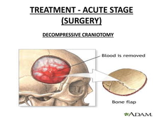 TREATMENT - ACUTE STAGE
(SURGERY)
DECOMPRESSIVE CRANIOTOMY
 