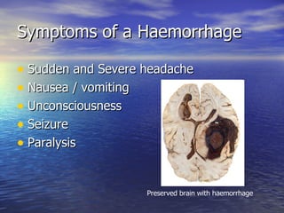 Symptoms of a Haemorrhage  Sudden and Severe headache Nausea / vomiting  Unconsciousness  Seizure Paralysis Preserved brain with haemorrhage 