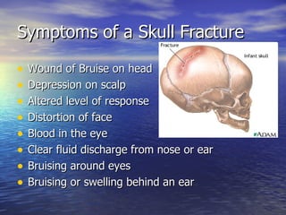Symptoms of a Skull Fracture Wound of Bruise on head Depression on scalp Altered level of response Distortion of face Blood in the eye Clear fluid discharge from nose or ear Bruising around eyes Bruising or swelling behind an ear 