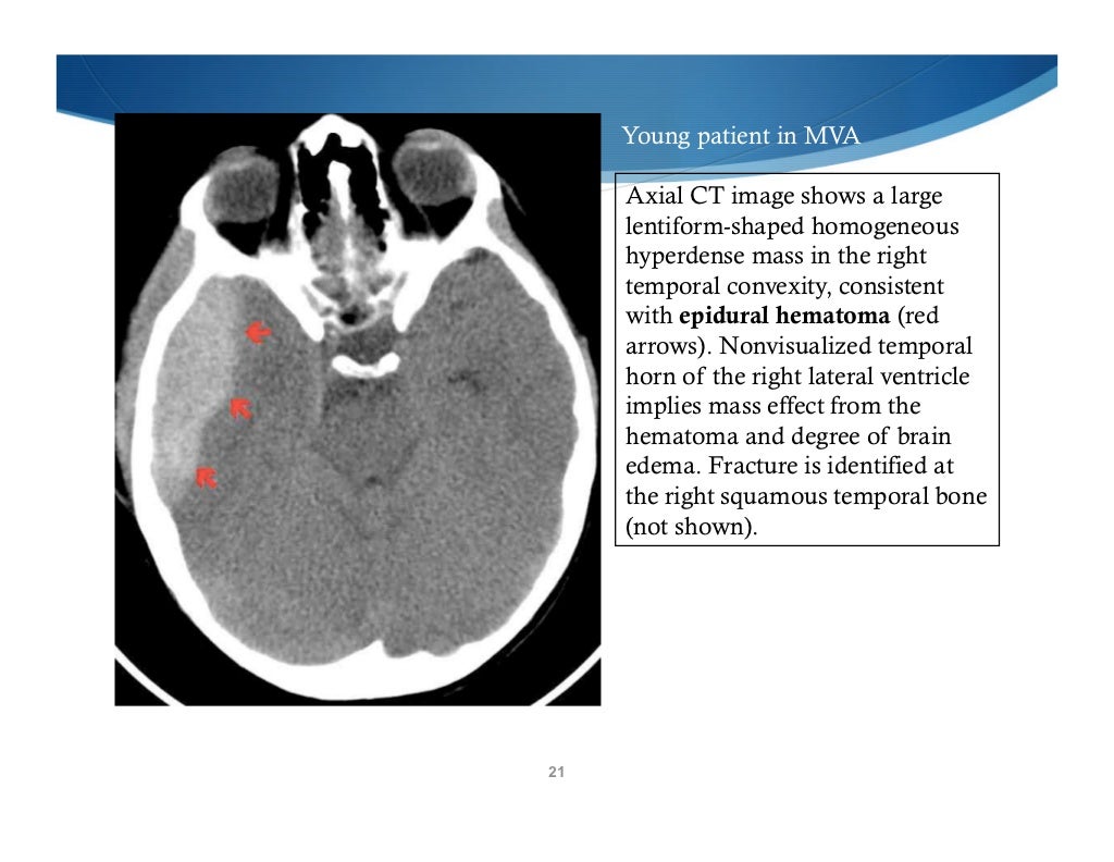 head trauma head trauma