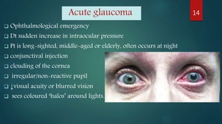 Acute glaucoma
 Ophthalmological emergency
 Dt sudden increase in intraocular pressure
 Pt is long-sighted, middle-aged or elderly, often occurs at night
 conjunctival injection
 clouding of the cornea
 irregular/non-reactive pupil
 ↓visual acuity or blurred vision
 sees coloured ‘halos’ around lights.
14
 