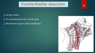 Vertebrobasilar dissection
 Acute onset
 Occipital/posterior neck pain
 Brainstem signs and symptoms
6
 