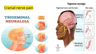Cranial nerve pain
 
