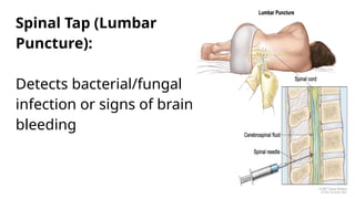 Spinal Tap (Lumbar
Puncture):
Detects bacterial/fungal
infection or signs of brain
bleeding
 