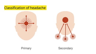 Classification of headache
 